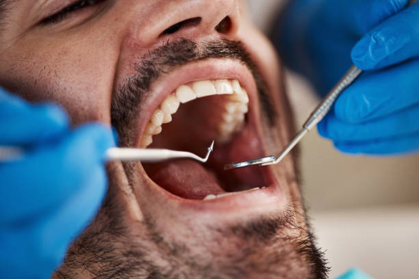 Full Mouth Reconstruction in Galesville, MD
