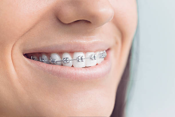 Best Full Mouth Reconstruction  in Galesville, MD